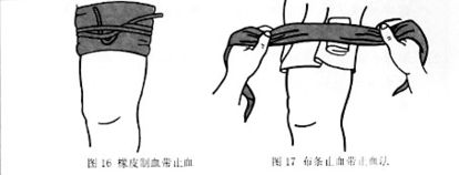 加壓包扎止血的注意事項