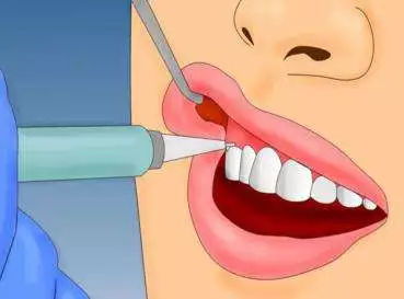 心臟病拔牙注意事項(xiàng)