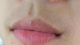 要注意,事項,去唇毛