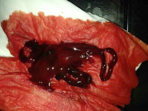 功血清宮后注意事項