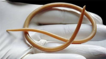 驅(qū)蛔蟲(chóng)注意事項(xiàng)