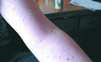 注意事項(xiàng),身體