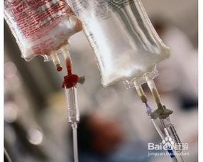 靜脈補(bǔ)鈣的原則及注意事項(xiàng),輸液補(bǔ)鈣時(shí)的注意事項(xiàng),腎結(jié)石補(bǔ)鈣注意事項(xiàng)