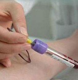 阿托品的用法用量及注意事項(xiàng),阿托品凝膠使用方法及注意事項(xiàng),阿托品散瞳后注意事項(xiàng)