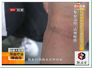 身體放血后注意事項(xiàng)