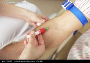 靜脈注射的目的和注意事項,靜脈注射白蛋白的注意事項,葡萄糖酸鈣靜脈注射注意事項