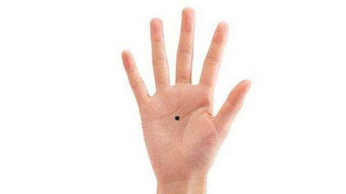 骨頭斷了飲食注意事項,手掌骨骨頭斷了有什么表現(xiàn),手掌骨頭斷了怎么辦