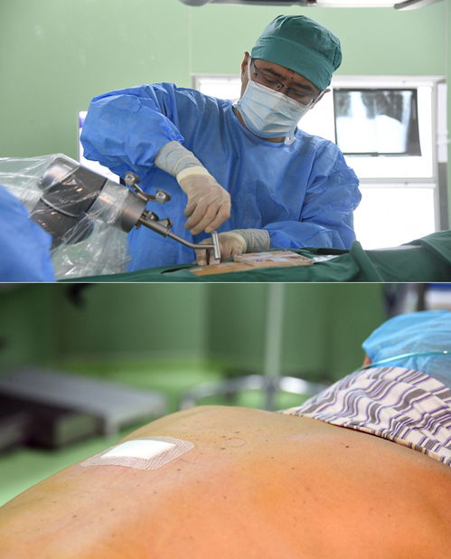 骨科手術(shù)鋪單的注意事項(xiàng)