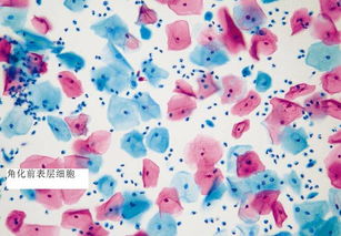 簡單染色法注意事項(xiàng)