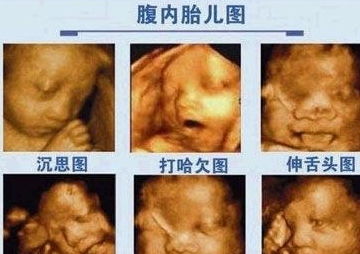 做排卵彩超前注意事項