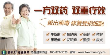 頭蘚注意事項(xiàng)