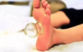 拔罐的禁忌和注意事項(xiàng),拔罐注意事項(xiàng)和禁忌癥,拔罐的操作流程及注意事項(xiàng)