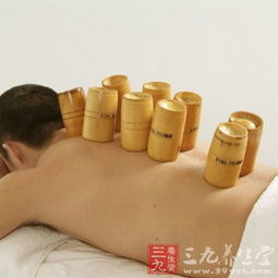 拔罐的注意事項(xiàng),撥罐走罐后注意事項(xiàng),撥胃管注意事項(xiàng)