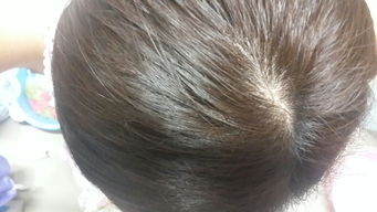 頭發(fā),注意事項