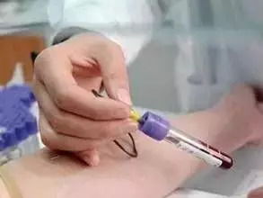 動(dòng)脈采血的注意事項(xiàng),采血的要點(diǎn)及注意事項(xiàng),靜脈采血注意事項(xiàng)8條