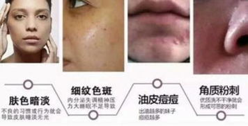 mts皮膚管理后注意事項(xiàng),mts皮膚管理的功效,mts皮膚管理是什么意思