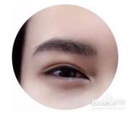 做了眉眼唇的注意事項,眉眼唇術后注意事項,眉眼提升術后注意事項