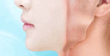 問題性皮膚注意事項,玫瑰痤瘡護膚注意事項,臉上痤瘡注意事項