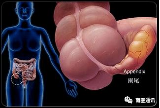 做了闌尾炎手術(shù)后要注意什么飲食,闌尾炎微創(chuàng)手術(shù)后飲食注意事項,闌尾炎輸液后飲食注意事項