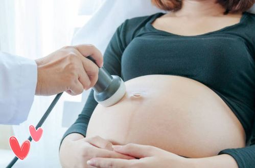 監(jiān)測(cè),注意事項(xiàng),胎心
