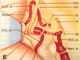 腦瘤放療的注意事項