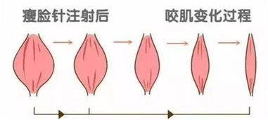 第一次打針注意事項
