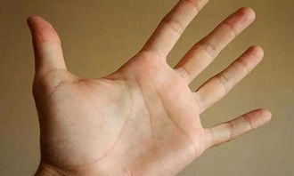 手掌,骨頭,注意事項