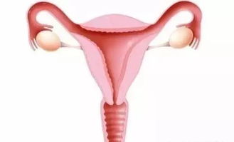 丅型環(huán)取環(huán)注意事項