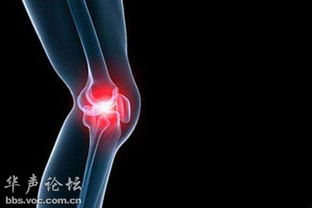 穿刺,關(guān)節(jié)炎,注意事項(xiàng)