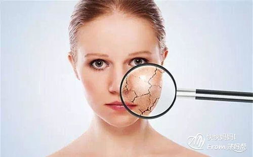 面部線雕術(shù)后注意事項