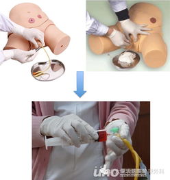 膀胱灌注化療注意事項中錯誤的是,膀胱灌注化療注意事項醫(yī)學(xué)生教育,膀胱灌注化療藥物注意事項