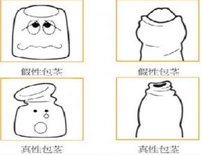 包莖手術過后的注意事項是哪些,割完包莖注意事項,男士割包莖注意事項