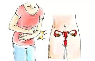 子宮壁厚清宮術后的注意事項