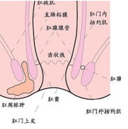 肛瘺確診前注意事項