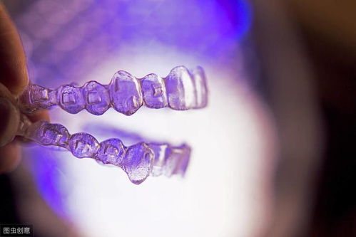 牙齒矯正器金屬注意事項