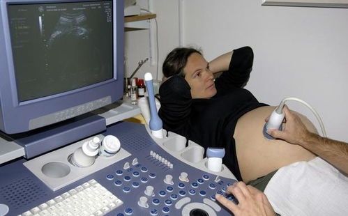 頭胎,高齡,孕婦,注意事項(xiàng)