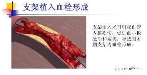 造影,注意事項(xiàng),醫(yī)學(xué)