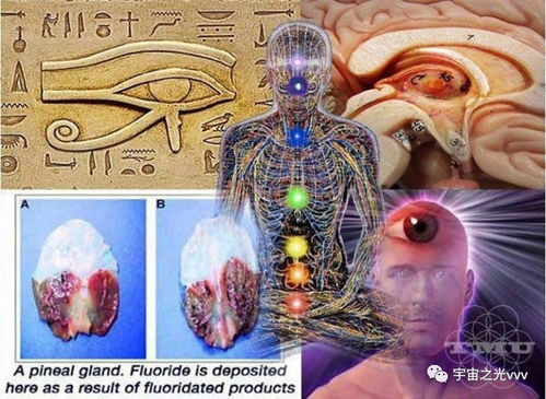 松果體鈣化注意事項(xiàng)