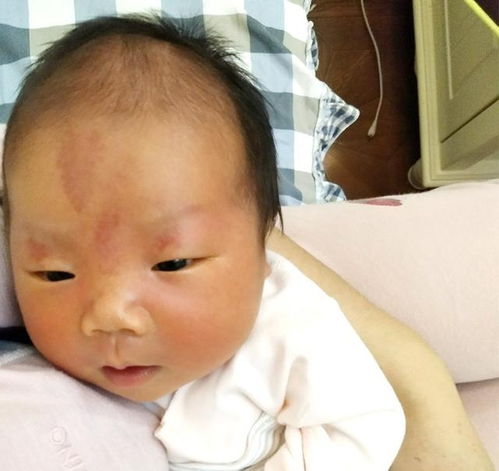 新生兒注意事項(xiàng)及護(hù)理,新生兒對(duì)燈光的注意事項(xiàng),新生兒第一個(gè)月注意事項(xiàng)