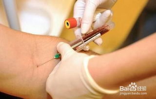 抽血驗過敏源注意事項