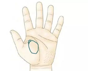 風(fēng)濕的注意事項,風(fēng)濕患者注意事項,風(fēng)濕關(guān)節(jié)痛注意事項