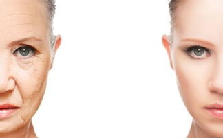 拉皮,注意事項,埋線