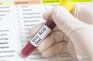 采血前病人的注意事項(xiàng)