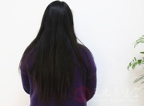 上海造影后注意事項