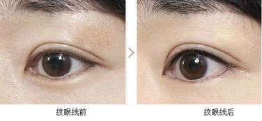 眼線,需注意,事項