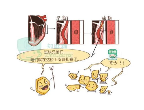 冠心病的注意事項(xiàng)有哪些,冠心病的注意事項(xiàng)有哪些健康一線,冠心病的注意事項(xiàng)有哪些五個(gè)