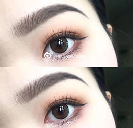 兒童散完瞳后注意事項(xiàng)