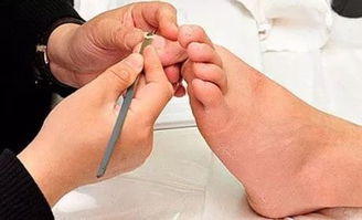 修治,注意事項(xiàng)