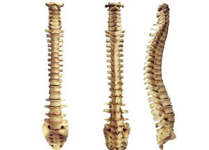 脊柱關(guān)節(jié)病的注意事項