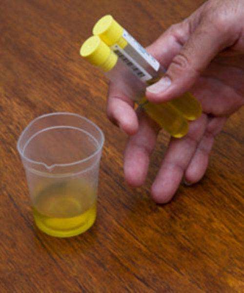 尿標本收集注意事項